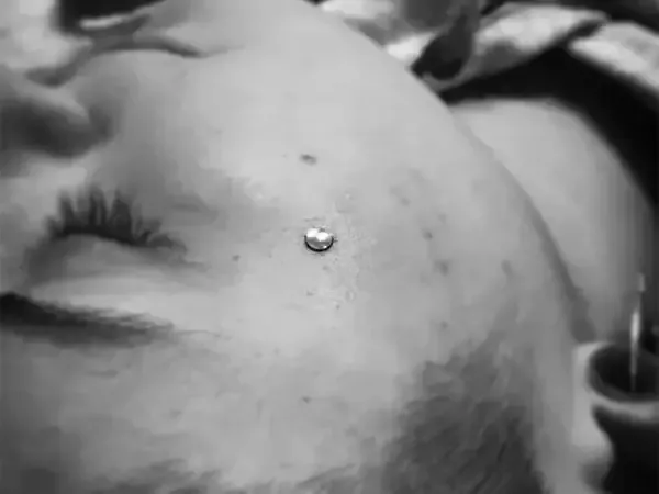 piercing dermal